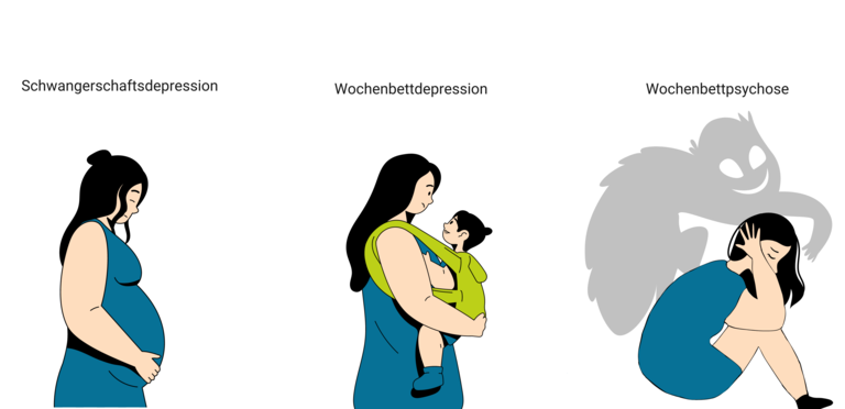 Grafik über die verschiedenen Formen der Depression während der Schwangerschaft und nach der Geburt. | © MyHandicap / EnableMe