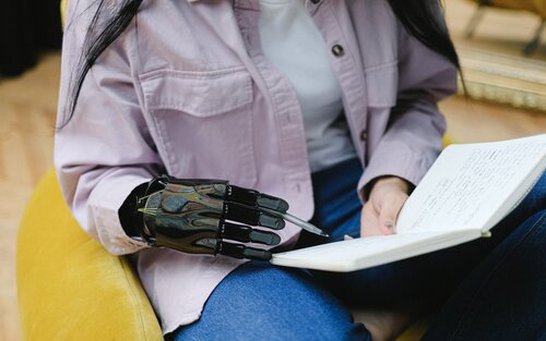 Eine Frau macht sich Notizen in einem Buch mit einer Handprothese. | © pexels