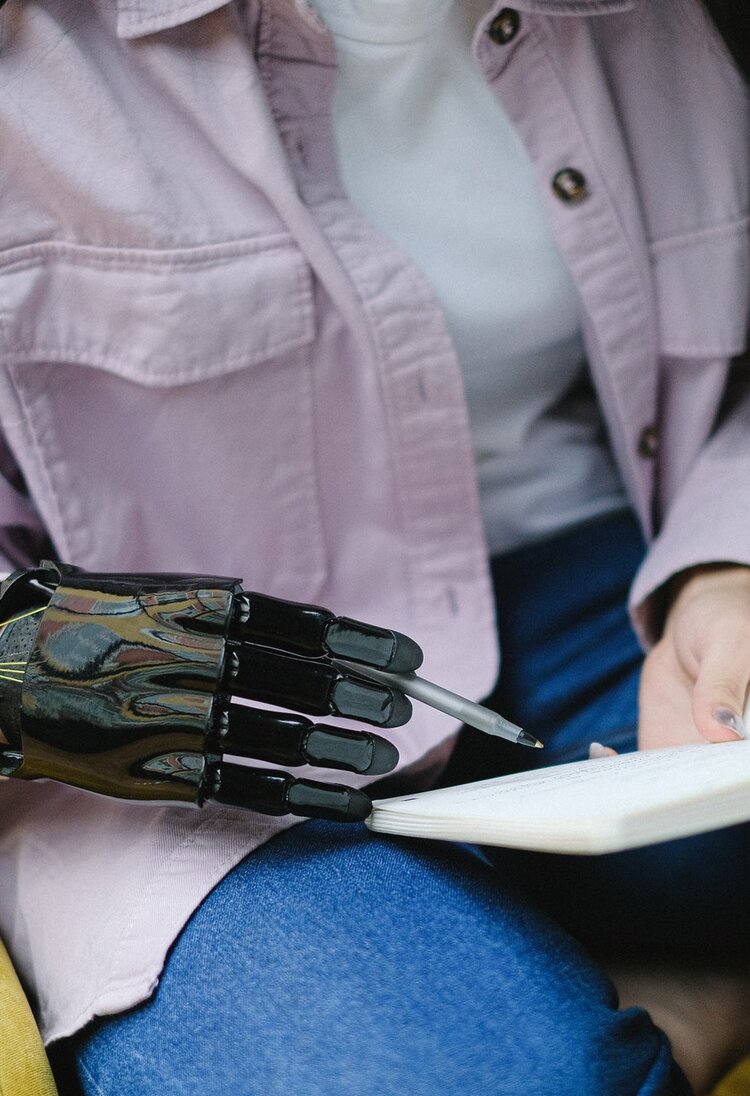 Eine Frau macht sich Notizen in einem Buch mit einer Handprothese. | © Pexels / Anna Shvets