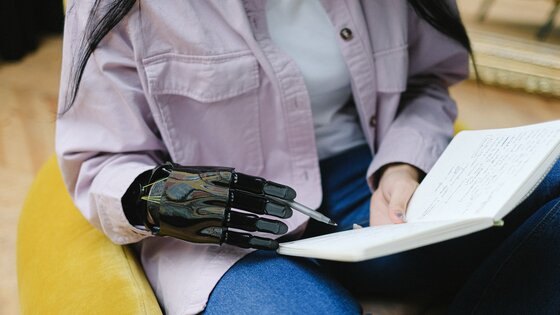 Eine Frau macht sich Notizen in einem Buch mit einer Handprothese. | © Pexels / Anna Shvets